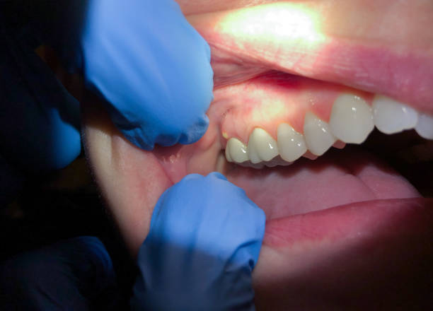 Best Pediatric Emergency Dentist in Nelsonville, OH