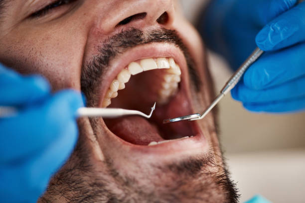 Best Weekend Emergency Dentist in Nelsonville, OH